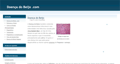 Desktop Screenshot of doencadobeijo.com